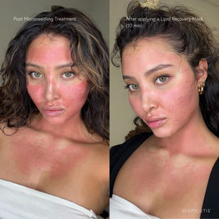Lipid Recovery Mask Neck and Décolleté