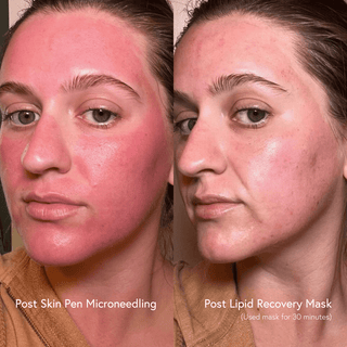 Lipid Recovery Mask Neck and Décolleté