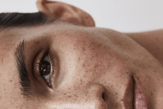 How to Treat Hyperpigmentation: Best Skincare for Dark Spots, Melasma, and Uneven Skin Tone