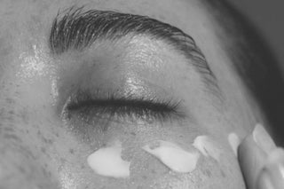 Soothe & Strengthen: Our Top Picks for Psoriasis-Prone Skin