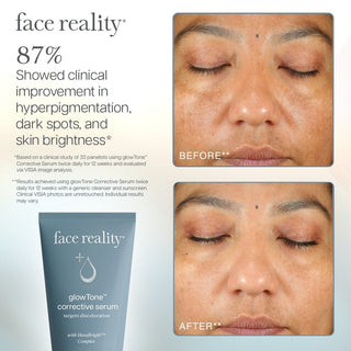 GlowTone Corrective Serum