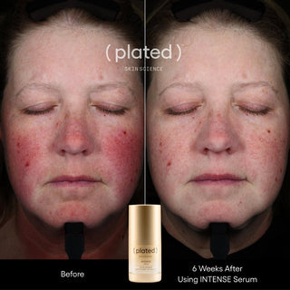 INTENSE Serum