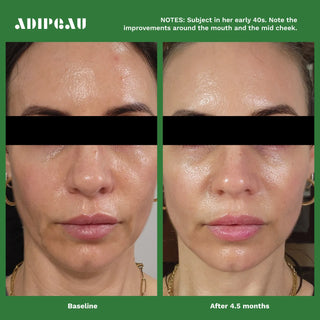 Volume Cream