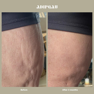 Strong Body Gel