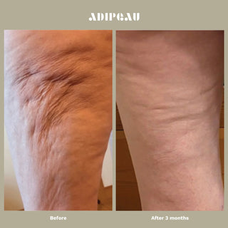 Strong Body Gel