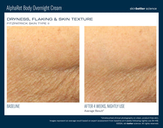 AlphaRet Body Overnight Cream
