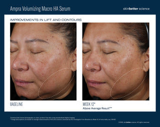 Ampra Volumizing Macro HA Serum