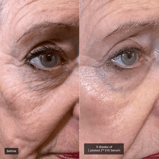 Eye Serum