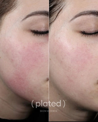 INTENSE Serum