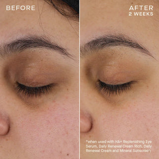 HA+ Replenishing Eye Serum