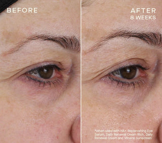 HA+ Replenishing Eye Serum