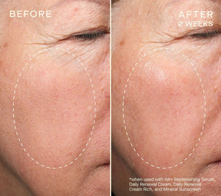 HA+ Replenishing Serum 30ml
