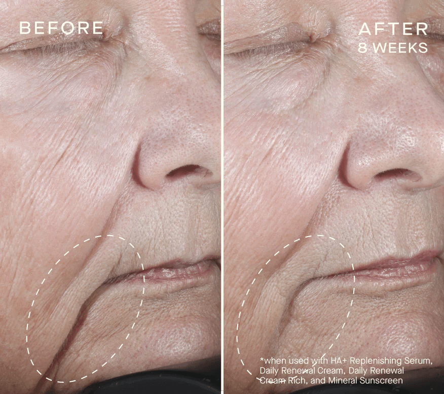 HA+ Replenishing Serum