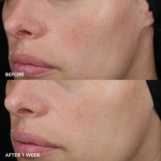 Barrier Repair Recovery Balm