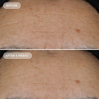 AGELESS+ retinol repair crème 0.3% retinol complex