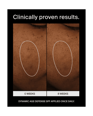 Before-and-after skin comparison showing two close-up facial skin panels labeled 0 Weeks and 8 Weeks, with white ovals highlighting texture and a headline reading 'Clinically proven results.' and 'Dynamic Age Defense SPF Applied Once Daily.
