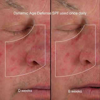 Dynamic Age Defense