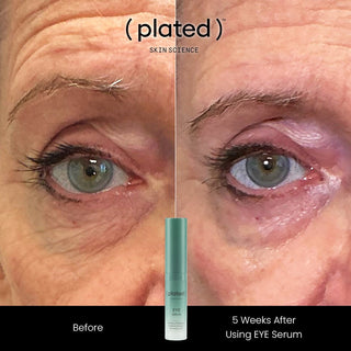 Before and after effect of using EYE Serum by plated Skin Science on a person's eye area.