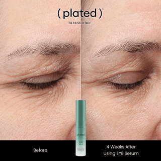 Before and after comparison of eye area with 'plated' eye serum, showing visible improvement.