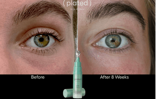 Before and after comparison of eye treatment with a dropper and product labeled 'plated' on a black background.