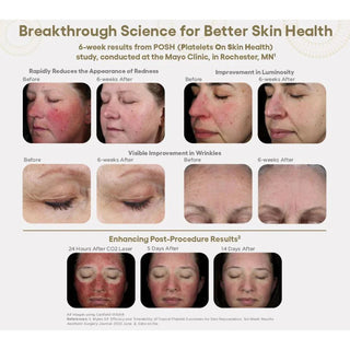 INTENSE Serum