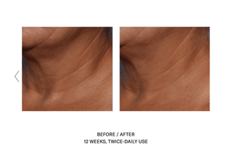 Techno Neck Perfecting Cream