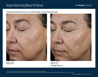 Ampra Volumizing Macro HA Serum