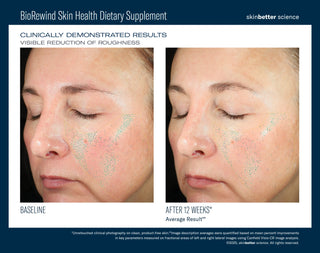 BioRewind Skin Health Dietary Supplement