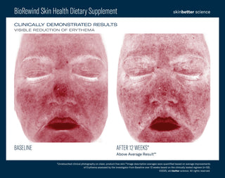 BioRewind Skin Health Dietary Supplement