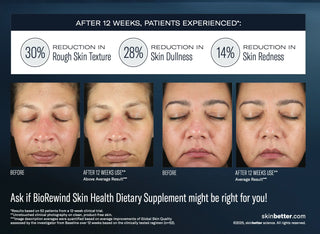 BioRewind Skin Health Dietary Supplement