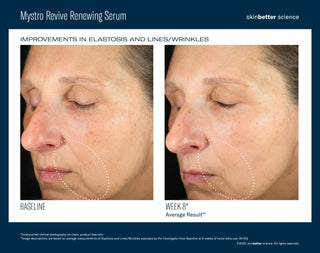 Mystro Revive Renewing Serum