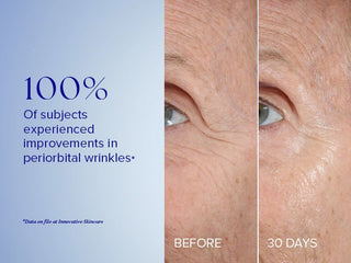 Youth Eye Complex