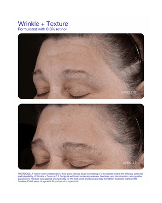 Before-and-after clinical study comparison of a woman's forehead, eyes, and cheeks showing wrinkle reduction and skin texture improvement over 12 weeks, with text detailing the protocol and 0.3% retinol content.