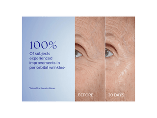 iS Clinical Youth Eye Complex 100% Improvements in Periorbital Wrinkles