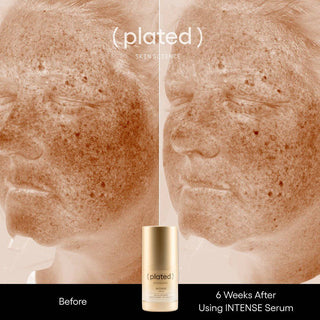 INTENSE Serum