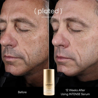 INTENSE Serum