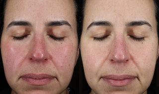 CALM Serum