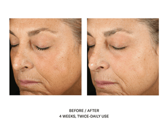 Skinbetter Alto Advanced Defense and Repair  Serum before and after. 4 Weeks, Twice-Daily Use. 