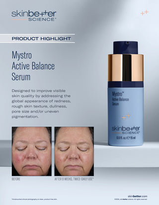 Skinbetter Mystro Active Balance Serum 15ml bottle. Product Highlights.