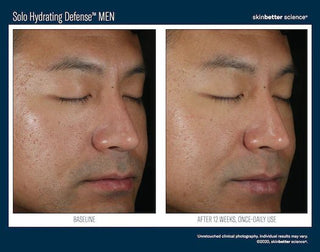 Skinbetter Solo Hydrating Defense Men Before and Afters. After 12 weeks, once-daily use.