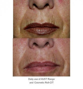 Cosmetic Gold Roll-Cit®